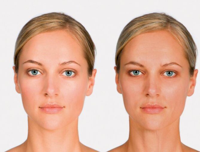 After rejuvenation and first face