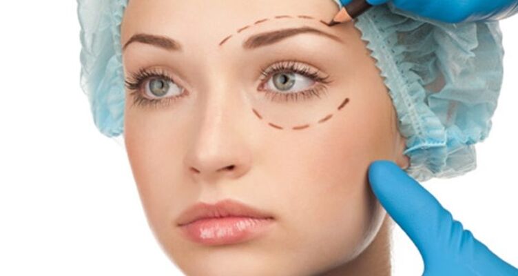 surgical removal