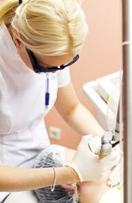 A doctor performs the photothermolysis procedure