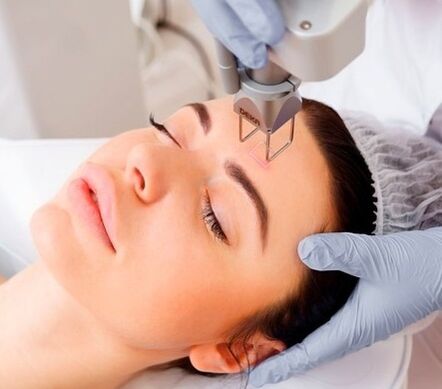 essence of fractional laser facial skin rejuvenation procedure